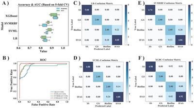 A comprehensive analysis of microbial community differences in four morphologies of mainstream anaerobic ammonia oxidation systems using big-data mining and machine learning